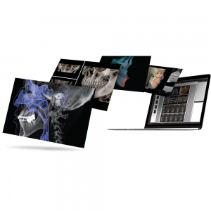 OnDemand3D Project Viewer Software OnDemand3D