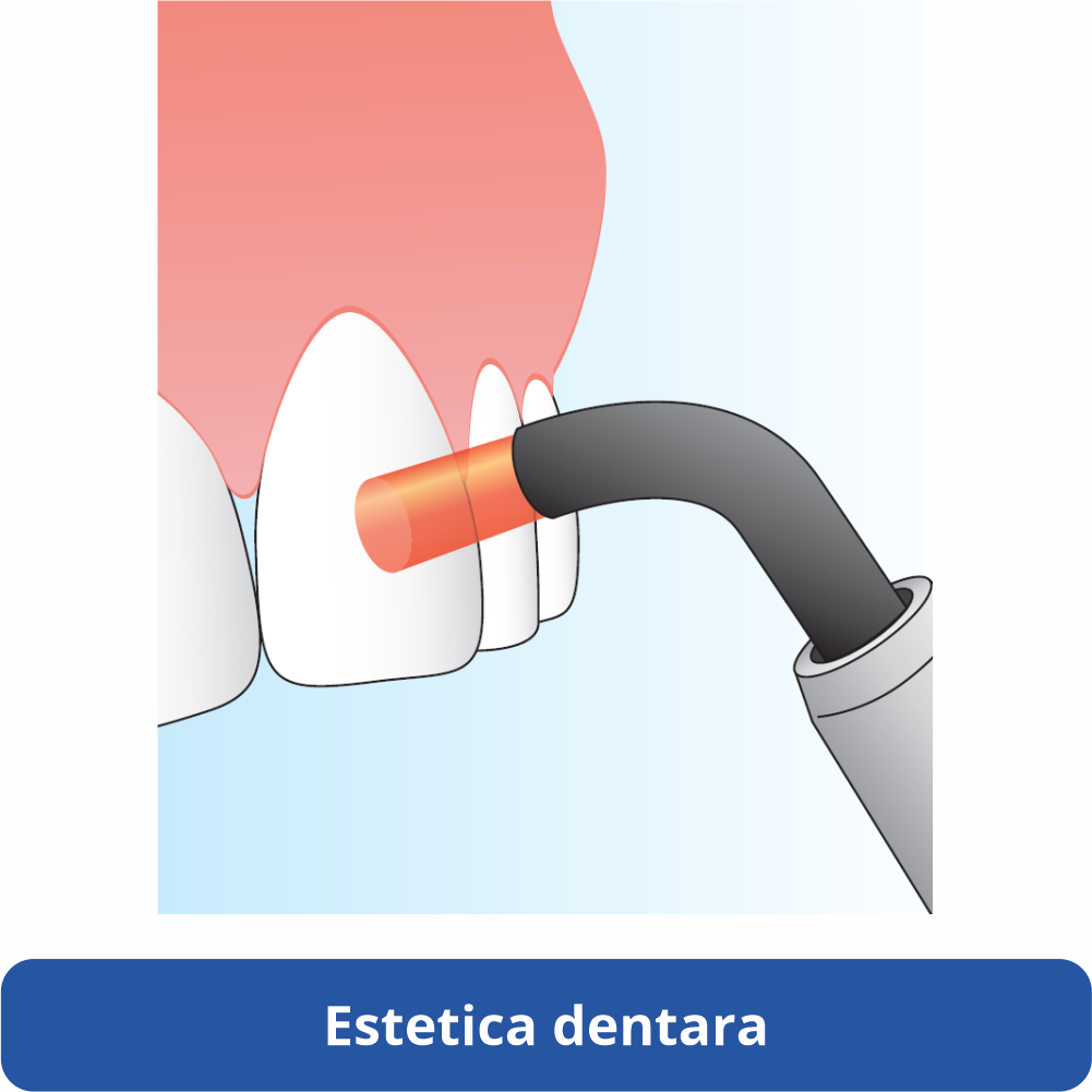 halmadent elexxion estetica dentara laser