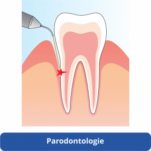 halmadent elexxion parodontologie laser