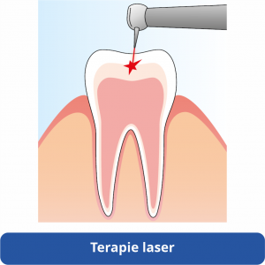 halmadent elexxion terapie laser