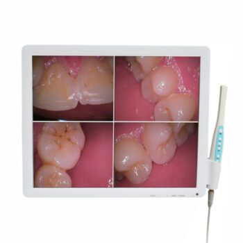 Kit multimedia 17 inch pentru stomatologie